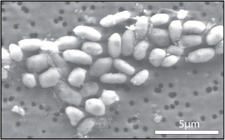 The GFAJ-1 bacteria, grown on arsenic