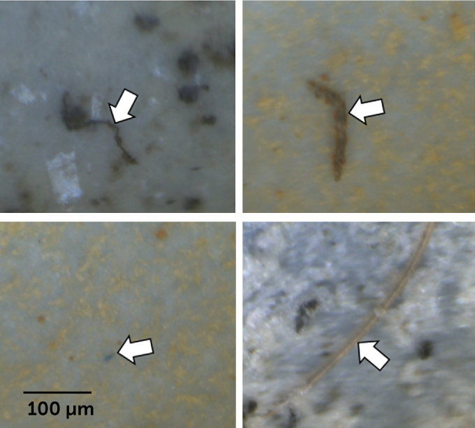 四张显微镜图像显示在人体肺组织中发现的微塑料颗粒。