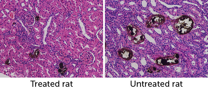 两张显微镜图像显示了给老鼠喂食促进肾结石生长的物质后肾结石的大小。 左边的图像显示了接受酸处理的老鼠的四个棕色小圆形形状，而右边的图像显示了未接受处理的老鼠的六个较大的棕色圆形形状。