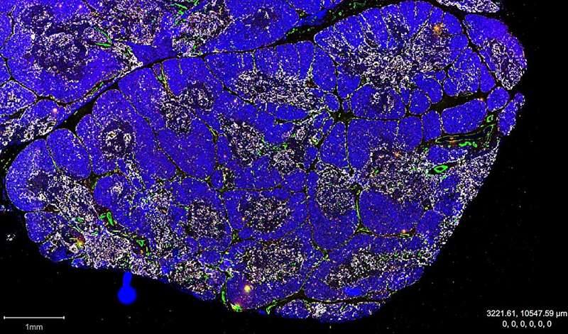 研究人员首次发现胸腺中的干细胞
