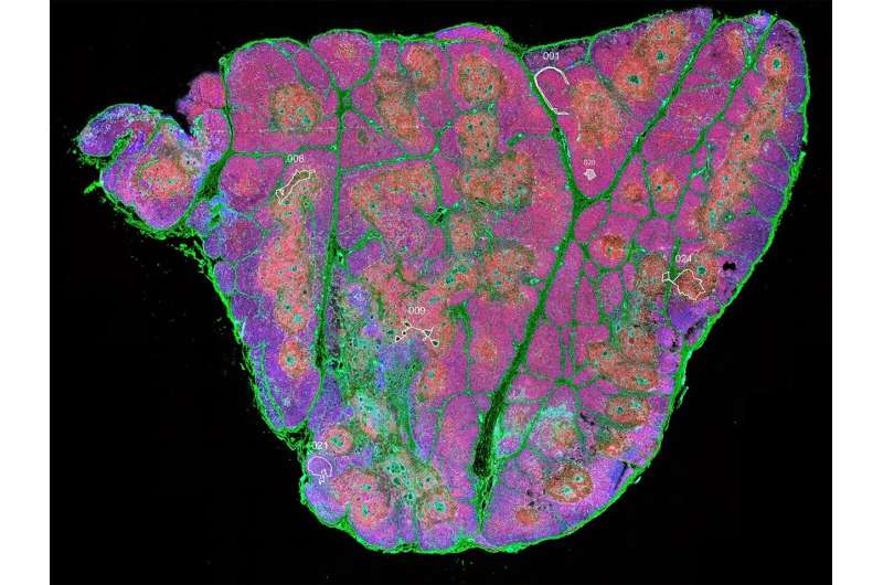 研究人员首次发现胸腺中的干细胞