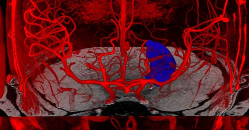 新研究扩展了对脑血流和神经系统疾病的理解