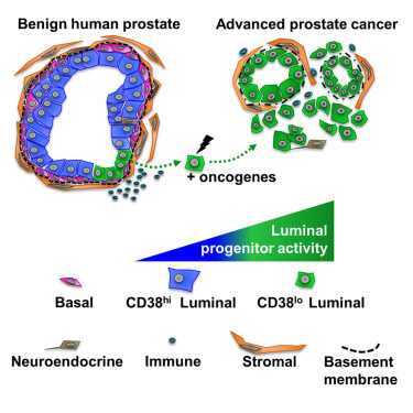 Cell Rep:新研究为炎症与前列腺癌风险关联性增添新证据