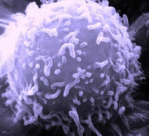 Nat Genet：突破！科学家发现相同肿瘤中存在不同遗传复杂性的癌细胞