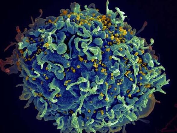 PNAS：重大突破！科学家阐明HIV如何成功感染机体