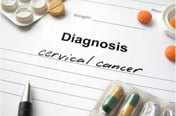 新发现: 宫颈癌死亡高于以前的估计