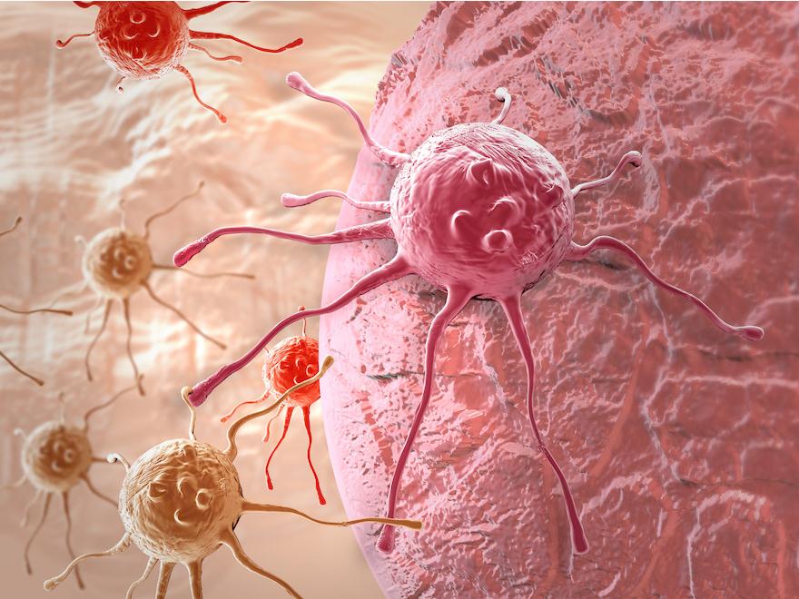 癌症：人工受体帮助标记难以发现的癌细胞，有望开创抗癌新疗法
