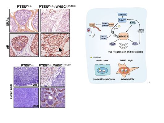 上海生科院发现组蛋白甲基转移酶WHSC1调控前列腺癌转移机制