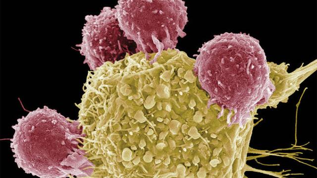 Science聚焦：个性化癌症疫苗的新“战绩”！