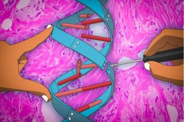 美国首个癌症基因疗法获FDA批准