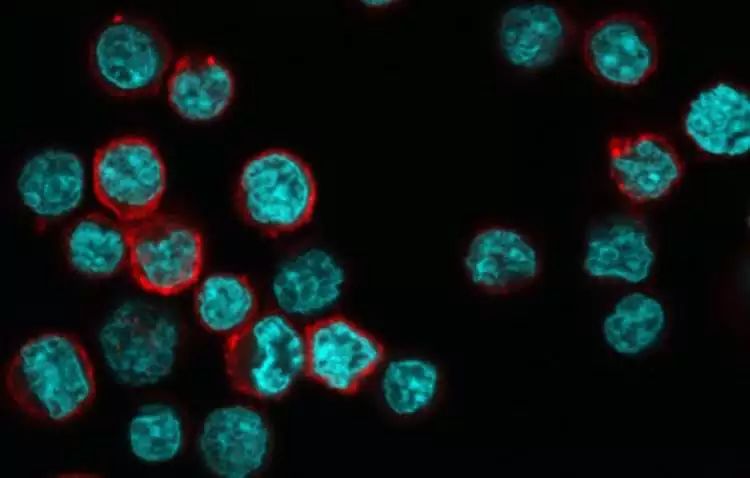 Nature子刊：CD4+T细胞表面有这种蛋白，抗癌能力最强！