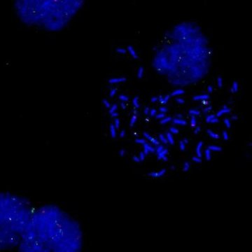 Nature子刊：新方法！科学家解锁多种癌细胞突变，可开发更具针对性的治疗