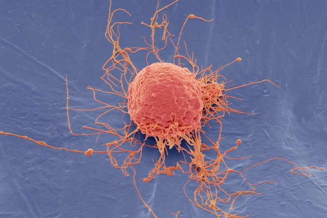 有争议？Nature评论文章：反思“间充质干细胞”这一概念
