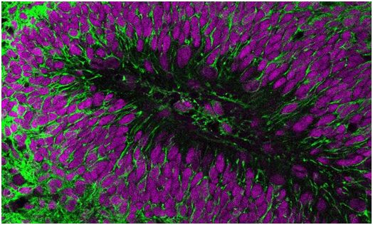 Science：将人脑细胞移植到小鼠大脑中有助深入认识唐氏综合症等神经疾病