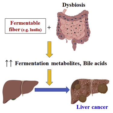 谨慎！Cell：膳食纤维引发肝癌？小鼠试验揭示与肠道菌有关
