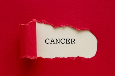 影响因子244.585的“神刊”：预防癌症，这件事“最重要”！