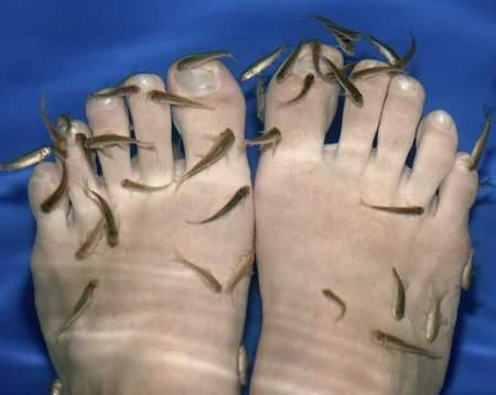 土耳其医生鱼真能治病吗专家解释治病机理