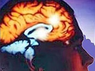 胖了会变笨？法国研究揭示肥胖与智力下降的关联