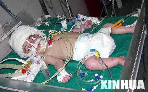 这是2005年2月19日，手术后的马纳尔接受护理。