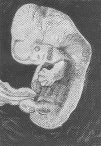 Bennett fig 3