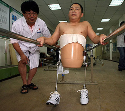 半截人用上了全球第一款“不可思议的假肢”