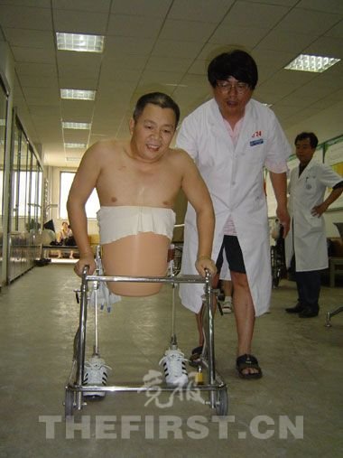 半截人用上了全球第一款“不可思议的假肢”