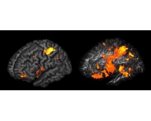 <b>PNAS：科学家绘制出影响人类智力大脑结构图</b>