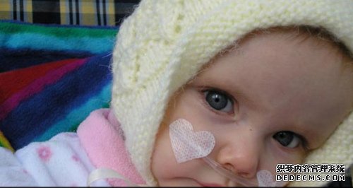 闭塞性细支气管炎（obliterative bronchiolitis）患者肺部呼吸道阻塞，组织出现颗粒，引起严重的呼吸困难。