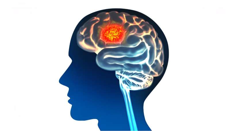 科学家利用人工智能预测脑癌结果