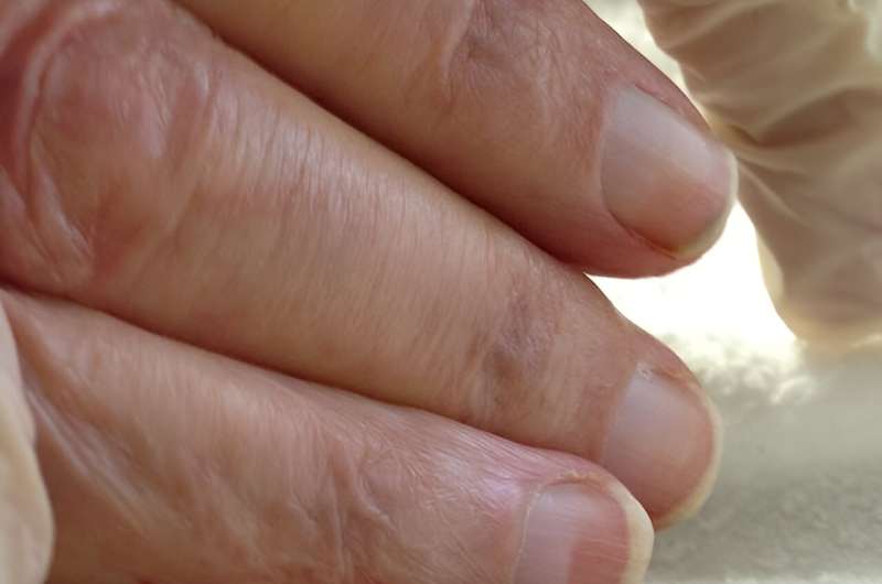从你的手看出你的健康状况