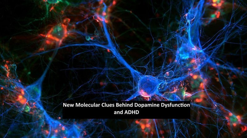 NSF蛋白缺失诱导纹状体D2受体神经元凋亡,揭示ADHD治疗新靶点