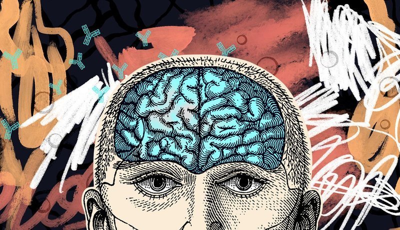 当免疫系统攻击大脑:自身免疫性脑炎与精神症状的迷局