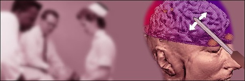 六项令人费解的诺贝尔奖 | Jandan.net