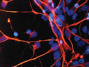 Cell Stem Cell：新方法可预测多能干细胞向神经细胞分化命运
