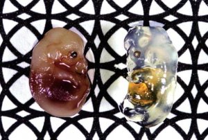 PNAS：围观压力的脑生理机制揭示——社会环境如何影响大脑奖励与决策