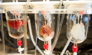 <b>科学家用病人自身细胞订做器官</b>