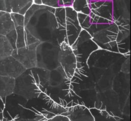 Curr Biol：揭示感觉神经元对于触觉重要性的分子机制