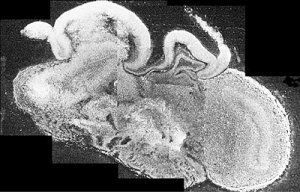 科学家在试管中培育出“类脑”组织：微型人脑模型助力神经疾病研究