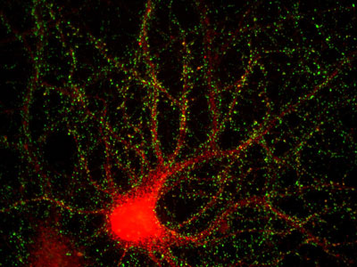 Science：两项研究揭示记忆形成的分子机制