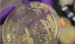 Science：科学家培育合成酵母染色体