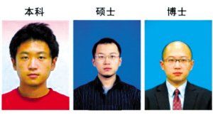 秃顶不是学历惹的祸 性激素是男性型脱发主因