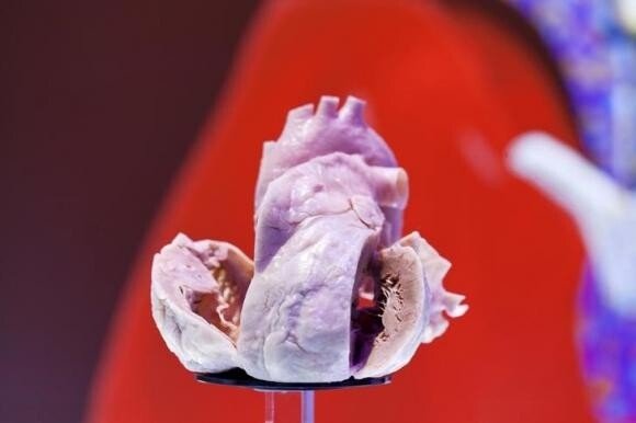 瑞士工程师借鉴钟表自动上发条原理，研发出无电池心脏起搏器