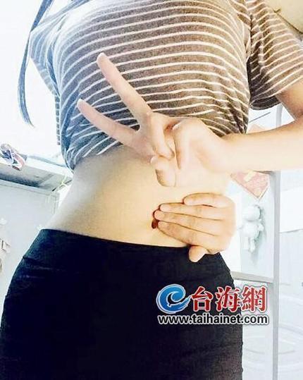 女子“炫腹”不成肌肉撕裂 专家：不能区分胖瘦