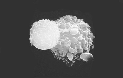 “以毒攻毒” 病毒抗癌 黑色素瘤新疗法为溶瘤细胞应用铺平道路