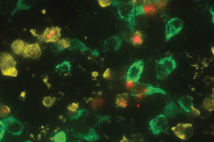 Cell：科学家揭示细胞死亡的替代路线