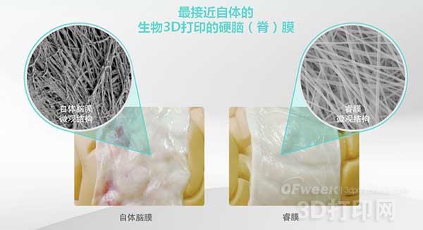 3D打印用于硬脑（脊）膜修复