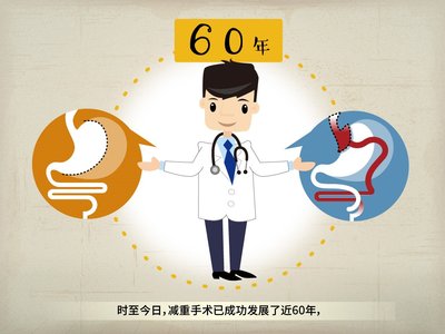 时至今日，减重手术已成功发展了近60年