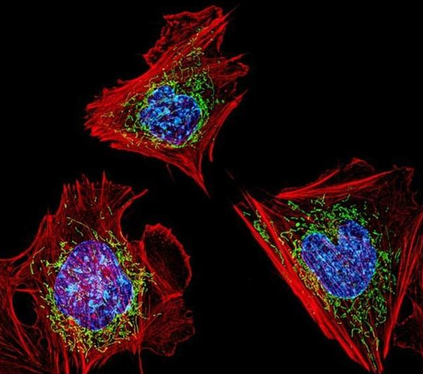 科学家发现不依靠线粒体供能的微生物：与细菌交换DNA