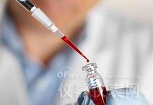 精准检测技术 30分钟即可确诊肺癌