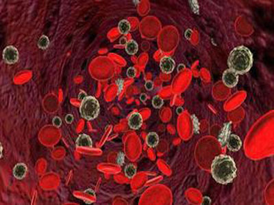 癌症血液基因检测真的靠谱吗